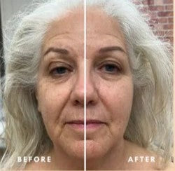 Matvir™ Lymphatic Face Brush